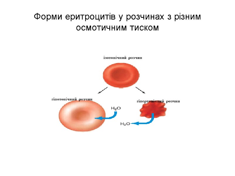 Форми еритроцитів у розчинах з різним осмотичним тиском